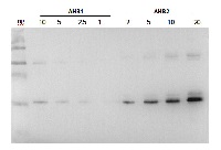 AHB2 | Hemoglobin 2 in the group Antibodies Plant/Algal  / Environmental Stress / Oxidative stress at Agrisera AB (Antibodies for research) (AS13 2745)